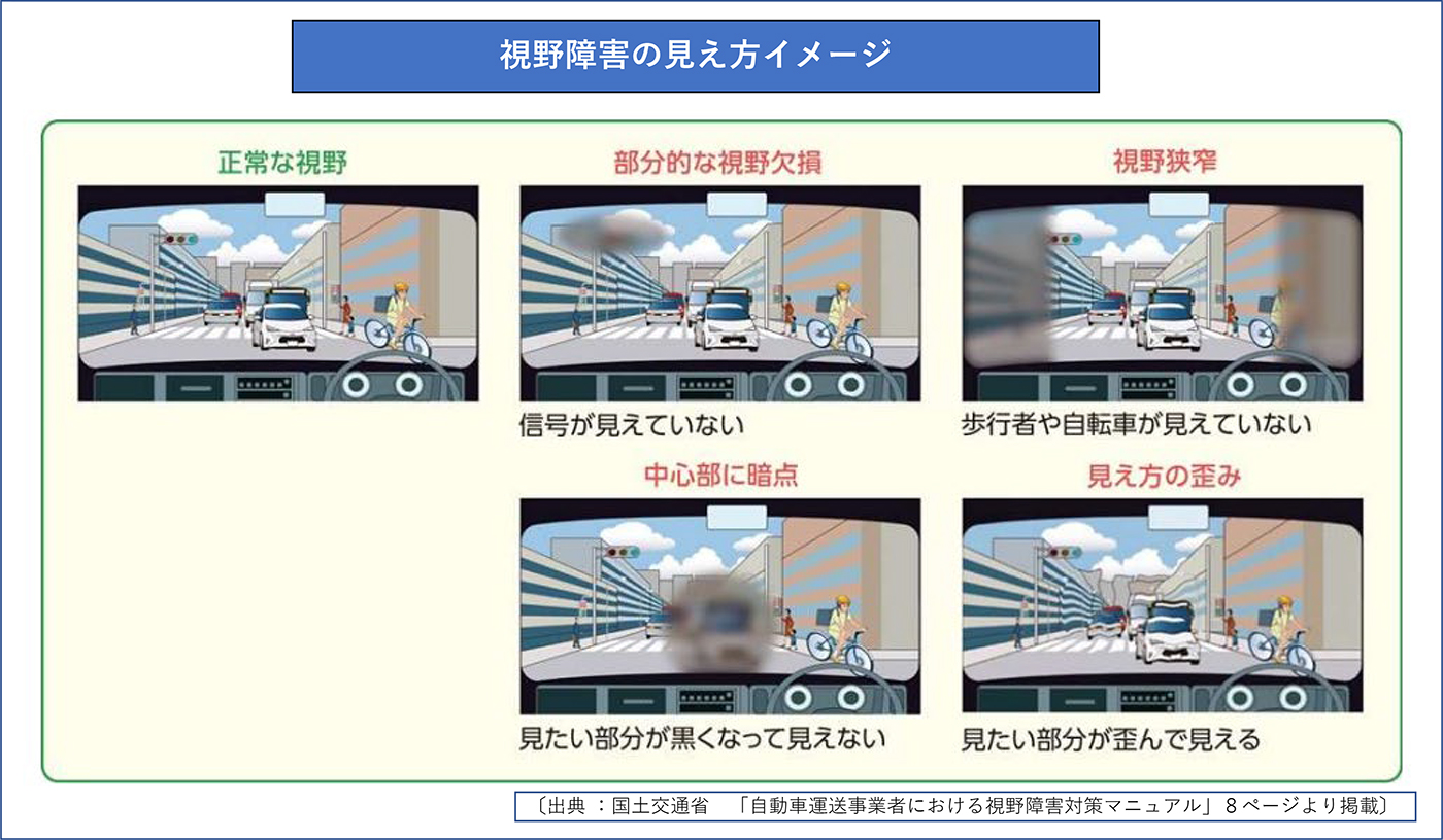 視野障害の見え方イメージ